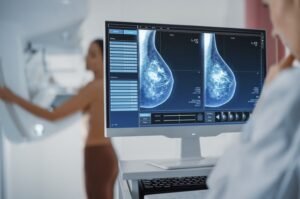 O número de mamografias realizadas pelo Cecon apresentou uma redução significativa ao longo da última década. Em 2015, foram 4.546 exames.