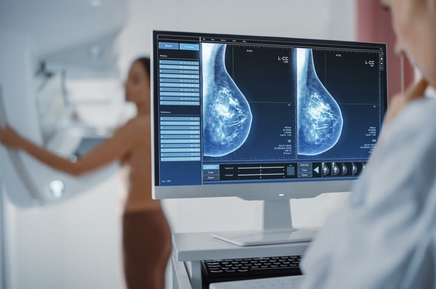O número de mamografias realizadas pelo Cecon apresentou uma redução significativa ao longo da última década. Em 2015, foram 4.546 exames.