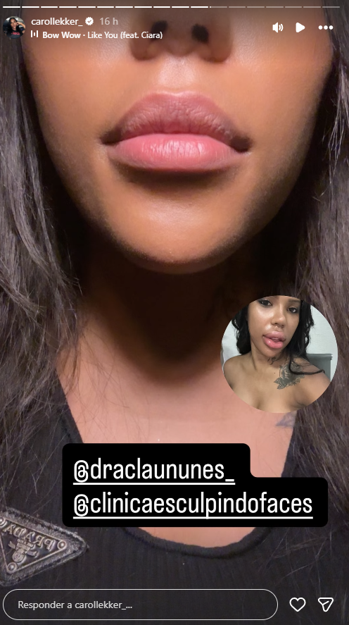 Reprodução: Instagram/@carollekker_