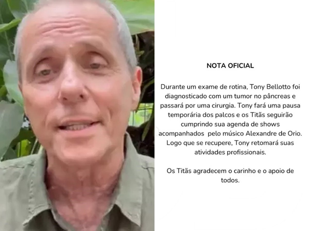Reprodução: Instagram/@tonybellottooficial
Reprodução: Instagram/@tonybellottooficial