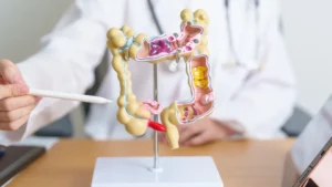 Pacientes com câncer colorretal têm medicamento aprovado pela Anvisa
