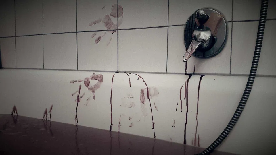 Ataque brutal no MA: mãe perde dedos ao tentar conter o próprio filho